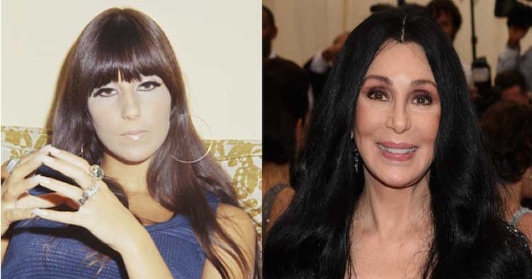 Cher plastic surgery