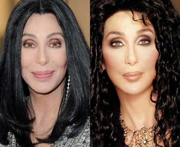 Cher Plastic Surgery: Breasts augmentation, Nose Job, Facelift