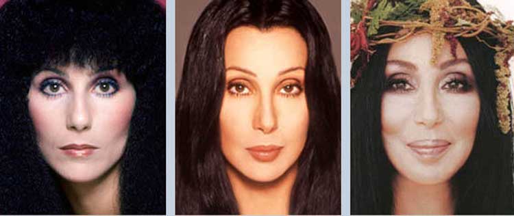 Cher plastic surgery