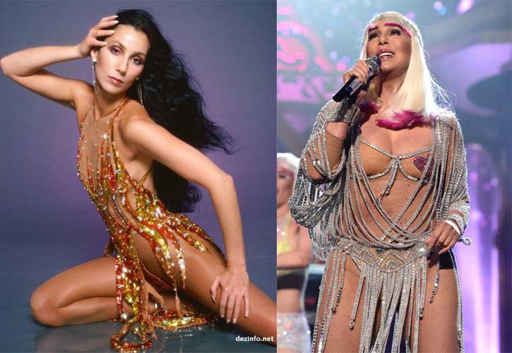 Cher plastic surgery