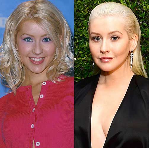 Christina Aguilera Plastic Surgery Boob Job, Nose job, Lip Filler, Botox