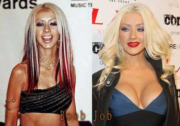 Christina Aguilera plastic surgery