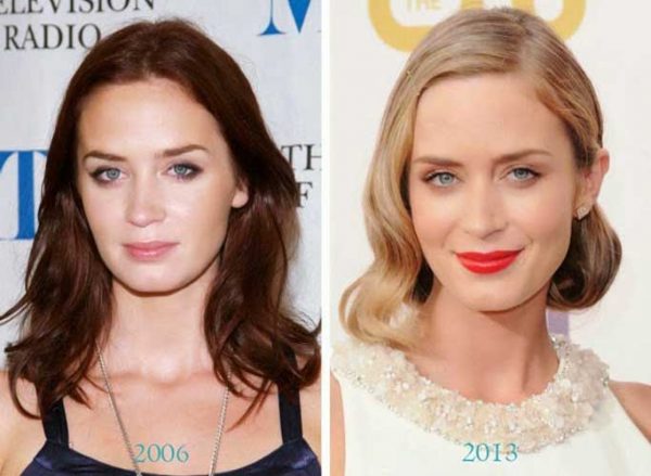 Emily Blunt Plastic Surgery: Rhinoplasty, Nose Job, Lip Augmentation