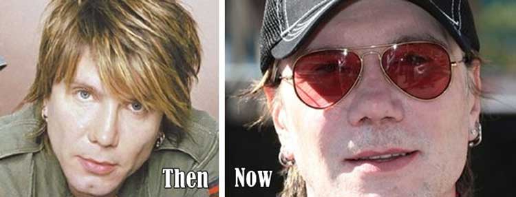 John Rzeznik plastic surgery