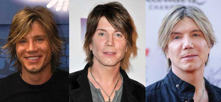 John Rzeznik plastic surgery