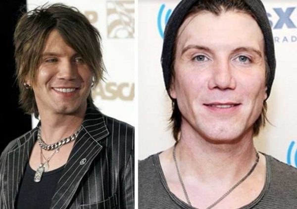 John Rzeznik Plastic Surgery: Nose Job, Facelift, Botox