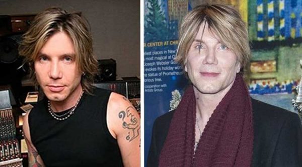 John Rzeznik Plastic Surgery: Nose Job, Facelift, Botox