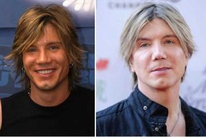 John Rzeznik Plastic Surgery: Nose Job, Facelift, Botox