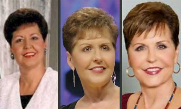 Joyce Meyer Plastic Surgery Chin Improvement Lip Augmentation Facelift