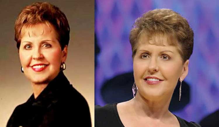 Joyce Meyer plastic surgery