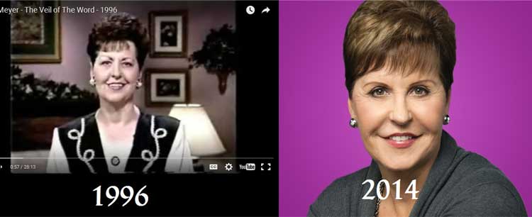 Joyce Meyer plastic surgery