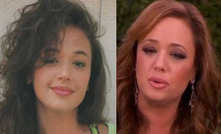 Leah Remini plastic surgery