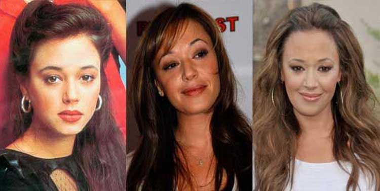 Leah Remini plastic surgery