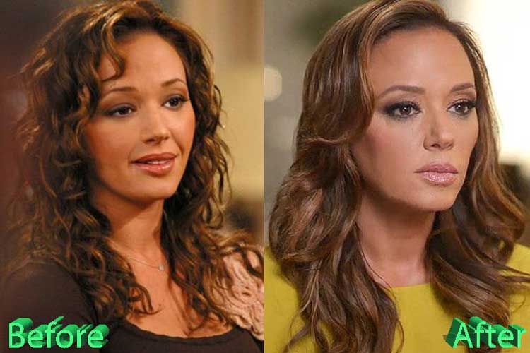 Leah Remini Plastic Surgery: Botox, Breast Increased, After and Before