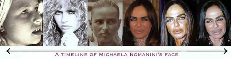 Michaela Romanini plastic surgery 