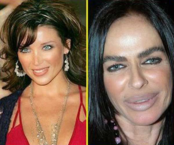 Michaela Romanini plastic surgery 