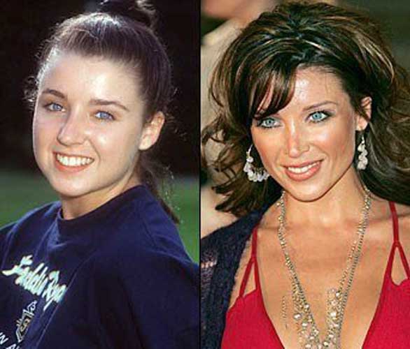 Michaela Romanini plastic surgery 