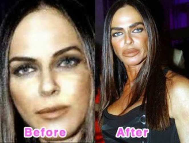 Michaela Romanini plastic surgery 