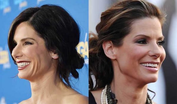 Sandra Bullock Plastic Surgery: Cheek Filler, Nose Job, Facelift