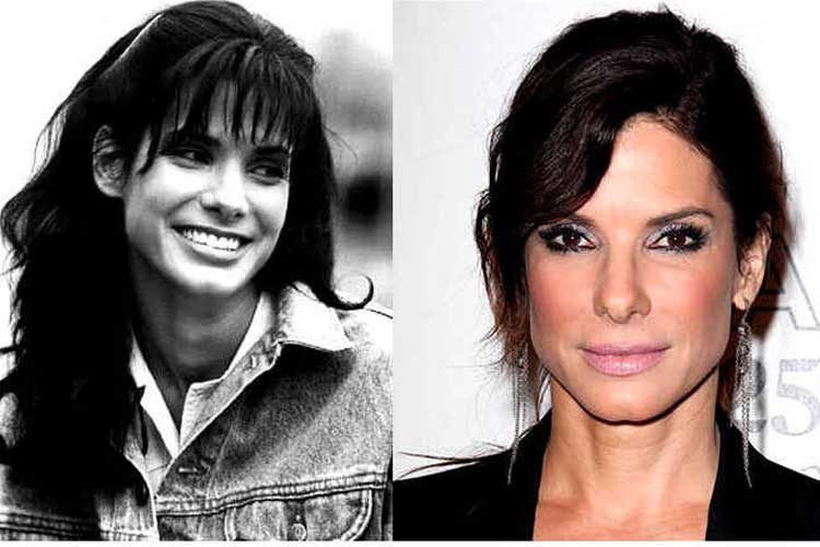 Sandra Bullock Plastic Surgery