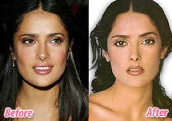 Salma Hayek plastic surgery