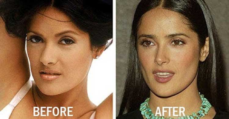 salma-hayek-plastic-surgery 