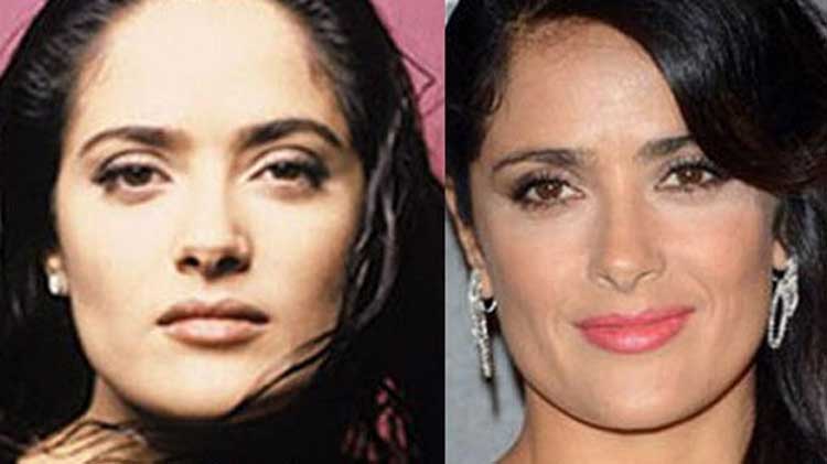 Salma Hayek plastic surgery