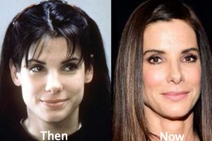 Sandra Bullock Plastic Surgery: Cheek Filler, Nose Job, Facelift