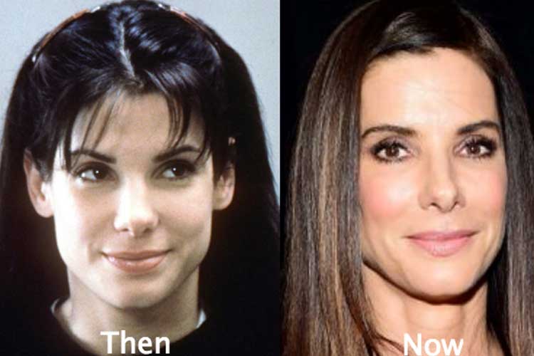 Sandra Bullock Plastic Surgery