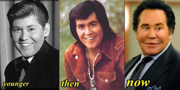 Wayne Newton Plastic Surgery: Facelift, Botox, Eyelid Surgery