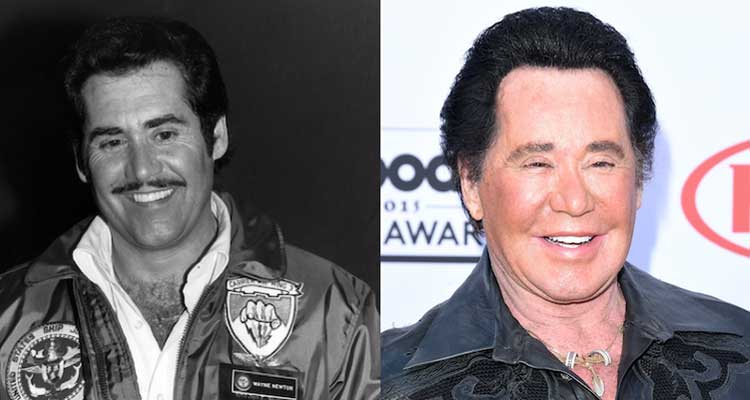 Wayne Newton Plastic Surgery: Facelift, Botox, Eyelid Surgery