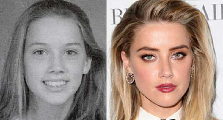 Amber Heard Plastic Surgery S T Implant Nose Job. 