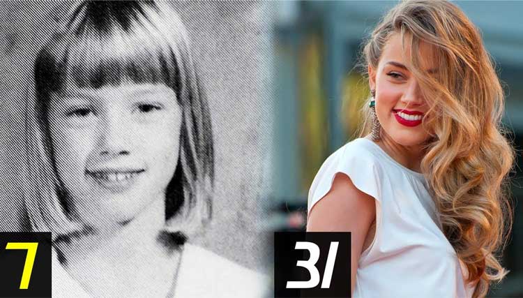 Amber Heard Plastic Surgery