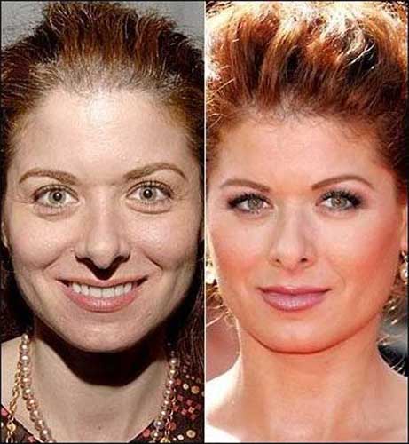 Debra Messing plastic surgery