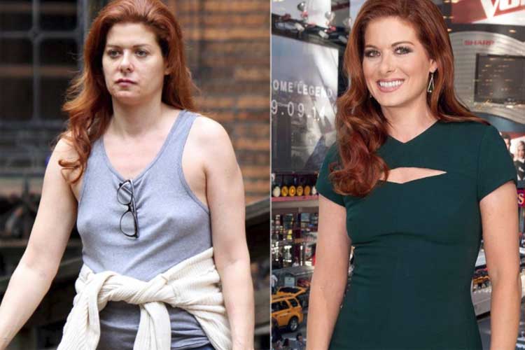 Debra Messing plastic surgery