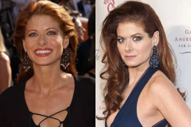 Debra Messing plastic surgery