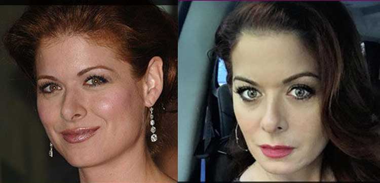 Debra Messing plastic surgery