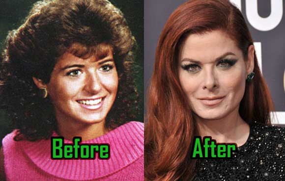 Debra Messing plastic surgery