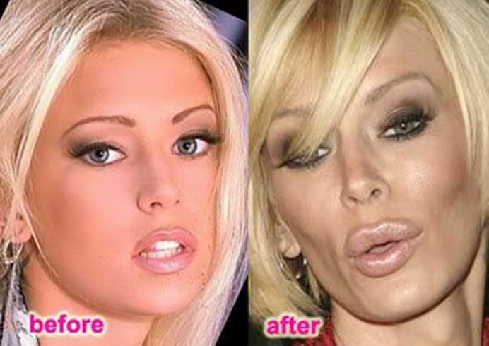 Jenna Jameson plastic surgery