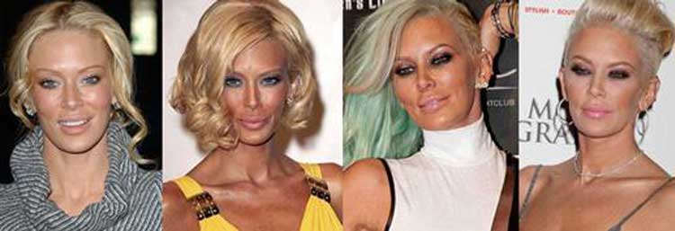 Jenna Jameson plastic surgery