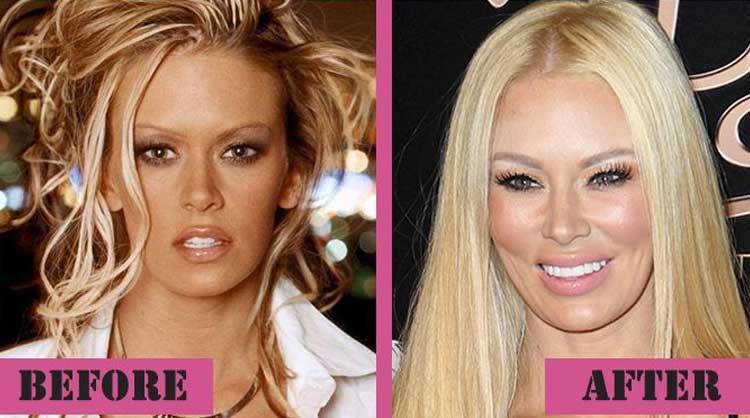 Jenna Jameson plastic surgery