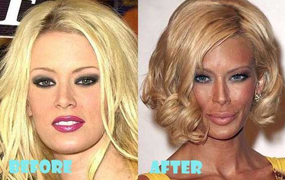 Jenna Jameson plastic surgery