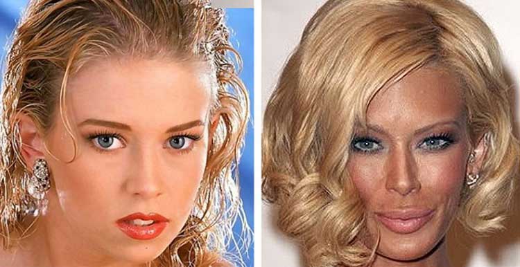 Jenna Jameson plastic surgery