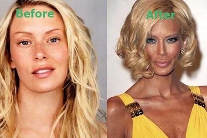 Jenna Jameson plastic surgery