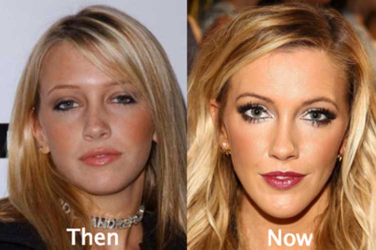 Katie Cassidy plastic surgery