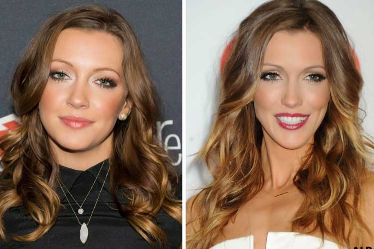 Katie Cassidy plastic surgery