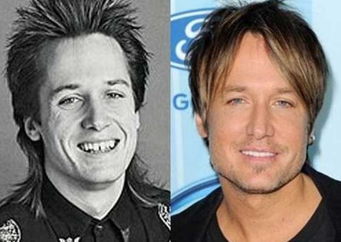 Keith Urban Nose job