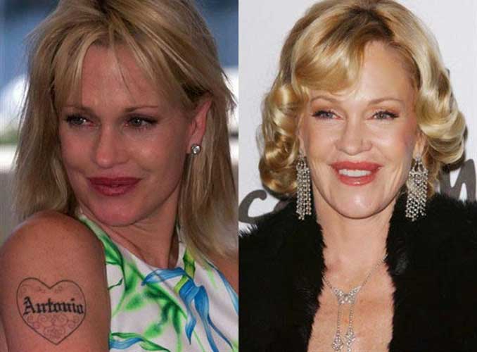 Melanie Griffith plastic surgery