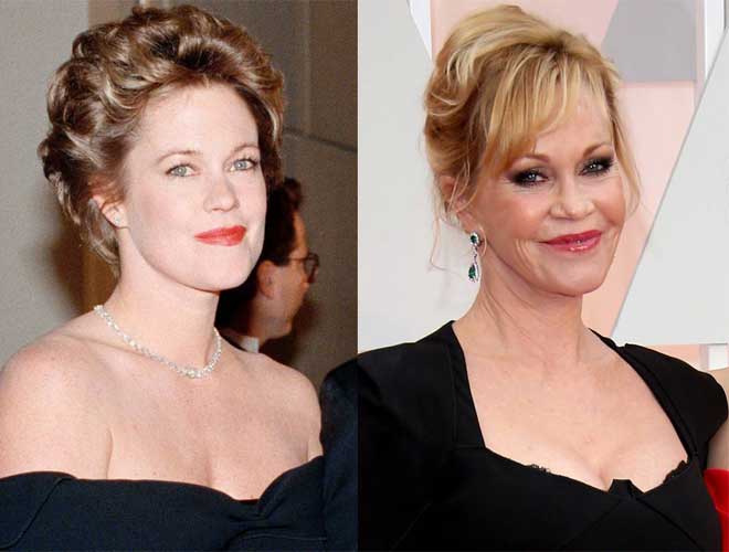 Melanie Griffith Plastic Surgery: Lip Augmentation ...