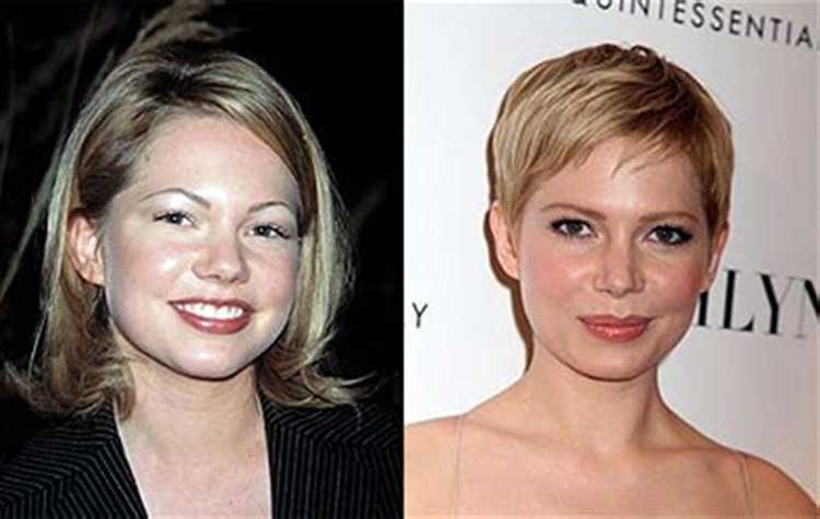 Michelle Williams plastic surgery